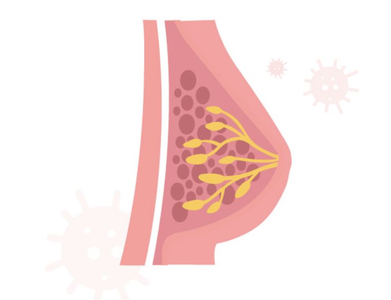 유방암 검진 이미지